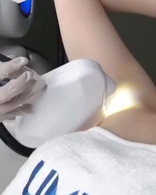 Umex lazer cihazının başlığıyla koltuk altına uygulama